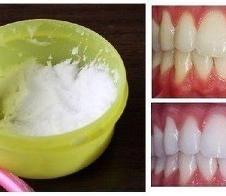Wonderful Idea for Natural Teeth Whitening in Minutes at Home