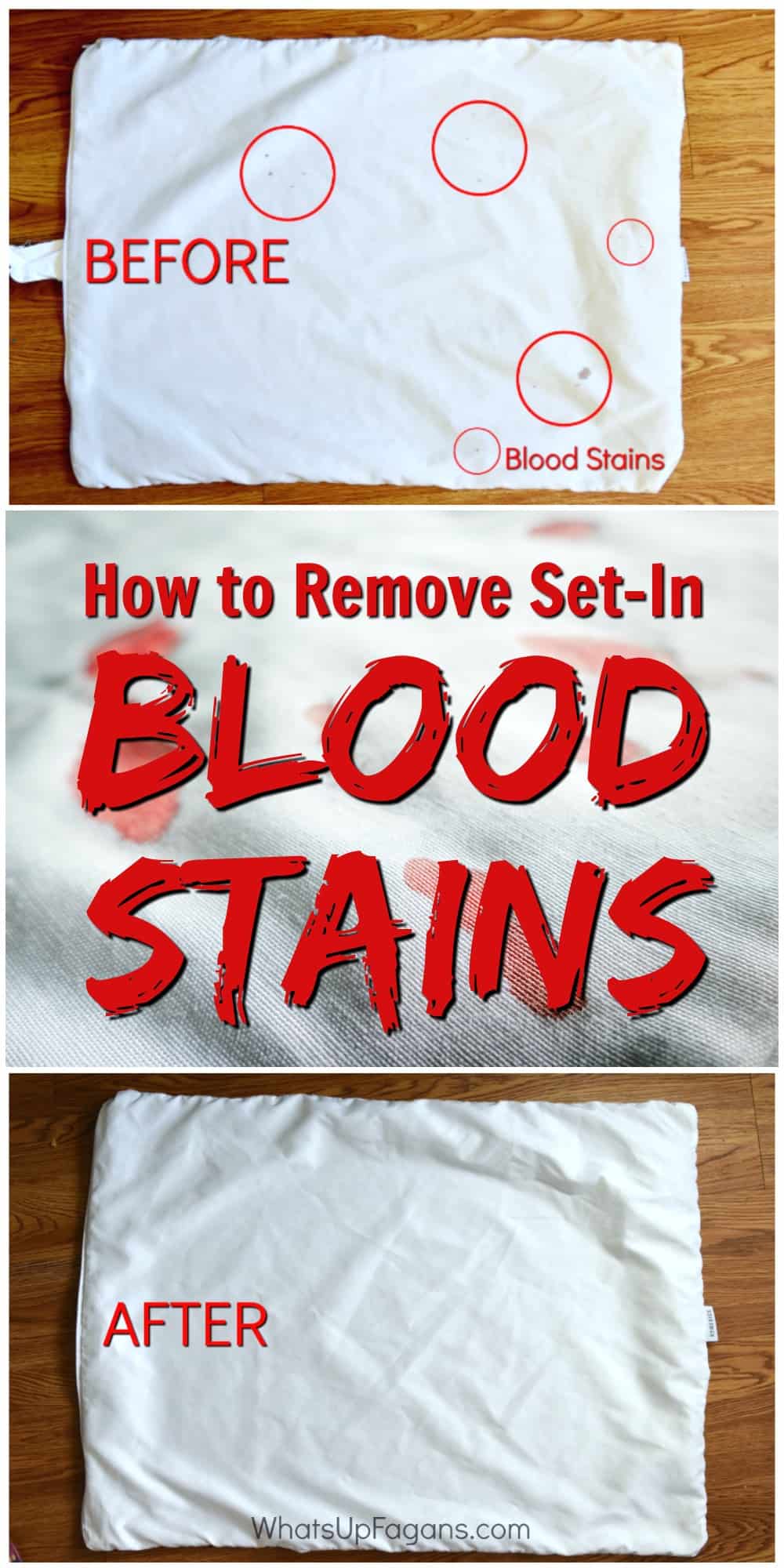 Getting rid of blood stains