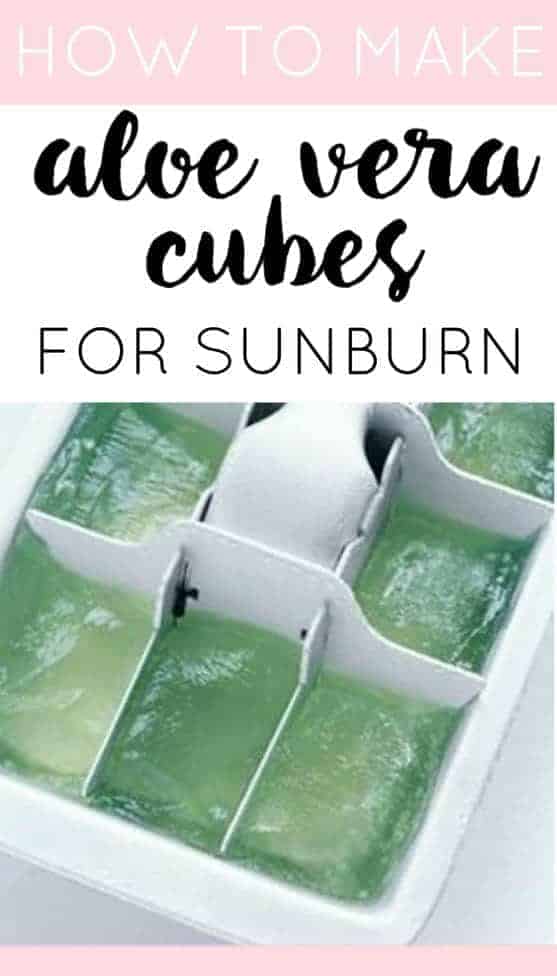 Make aloe vera cubes for sunburns